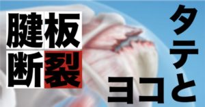 腱板断裂の「縦方向」と「横方向」