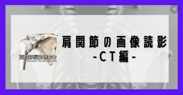 肩関節の画像読影-CT編-